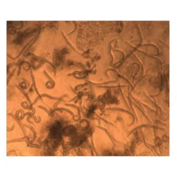 Environmental Toxicity Response in C. elegans