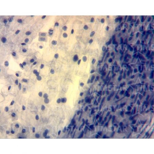 PM87135.jpg